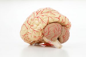 脳卒中のタイプでは出血性のものが多い